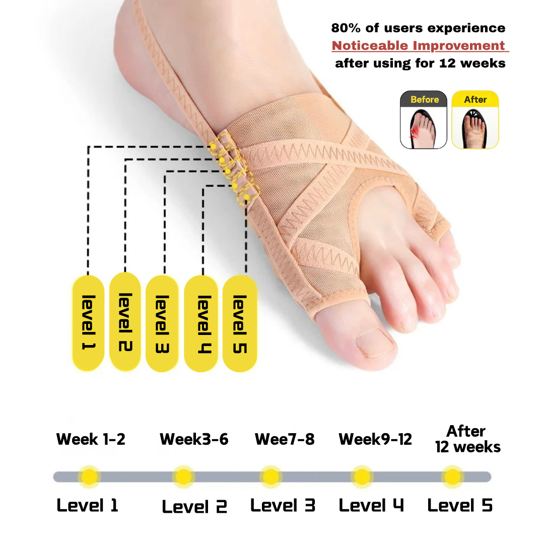 Hallux Valgus Correction