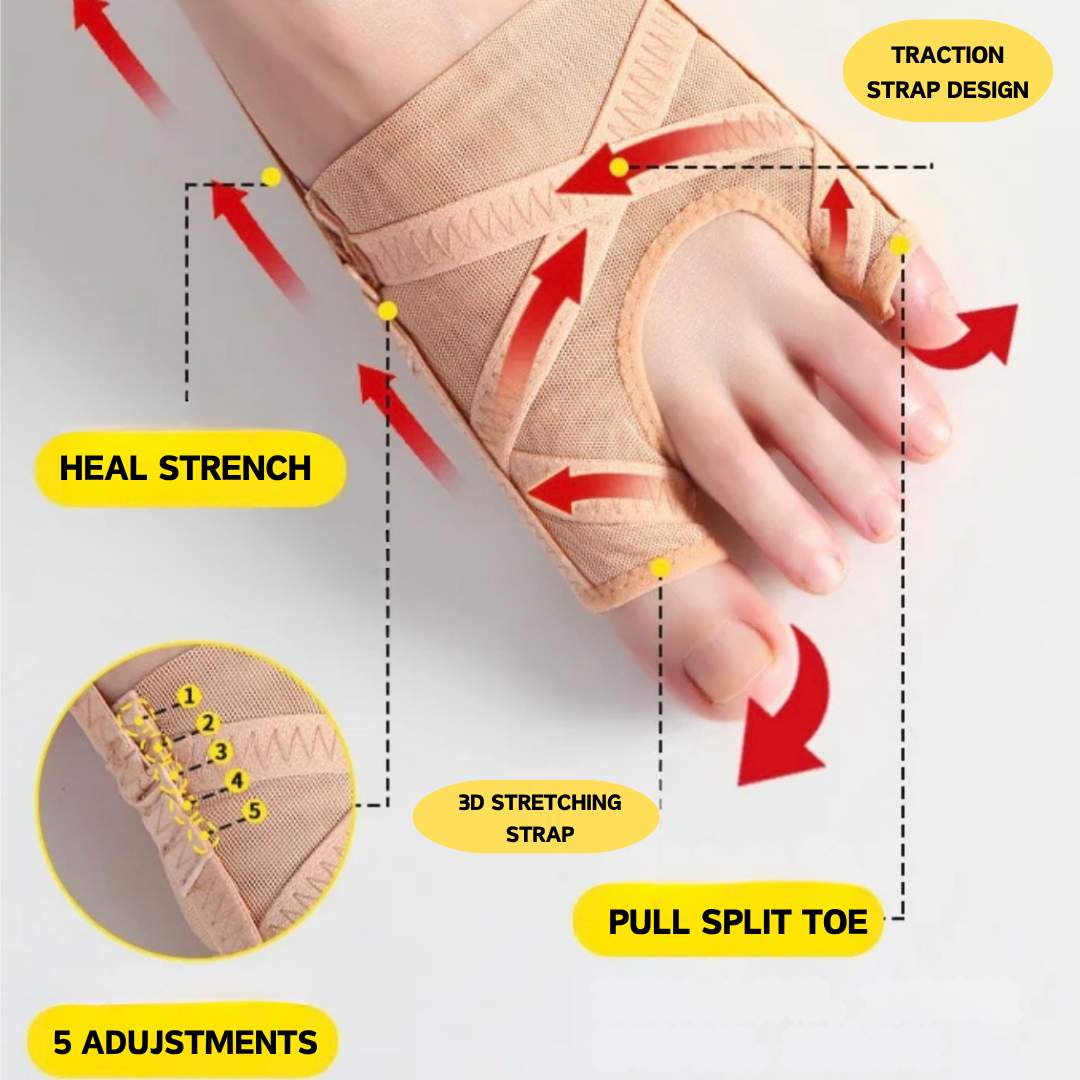 Hallux Valgus Correction