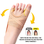 Hallux Valgus Correction