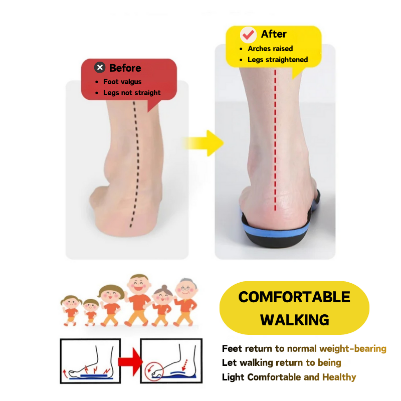 AkiraFlow™ Arch Support Insoles