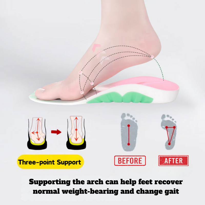 AkiraFlow™ Arch Support Insoles