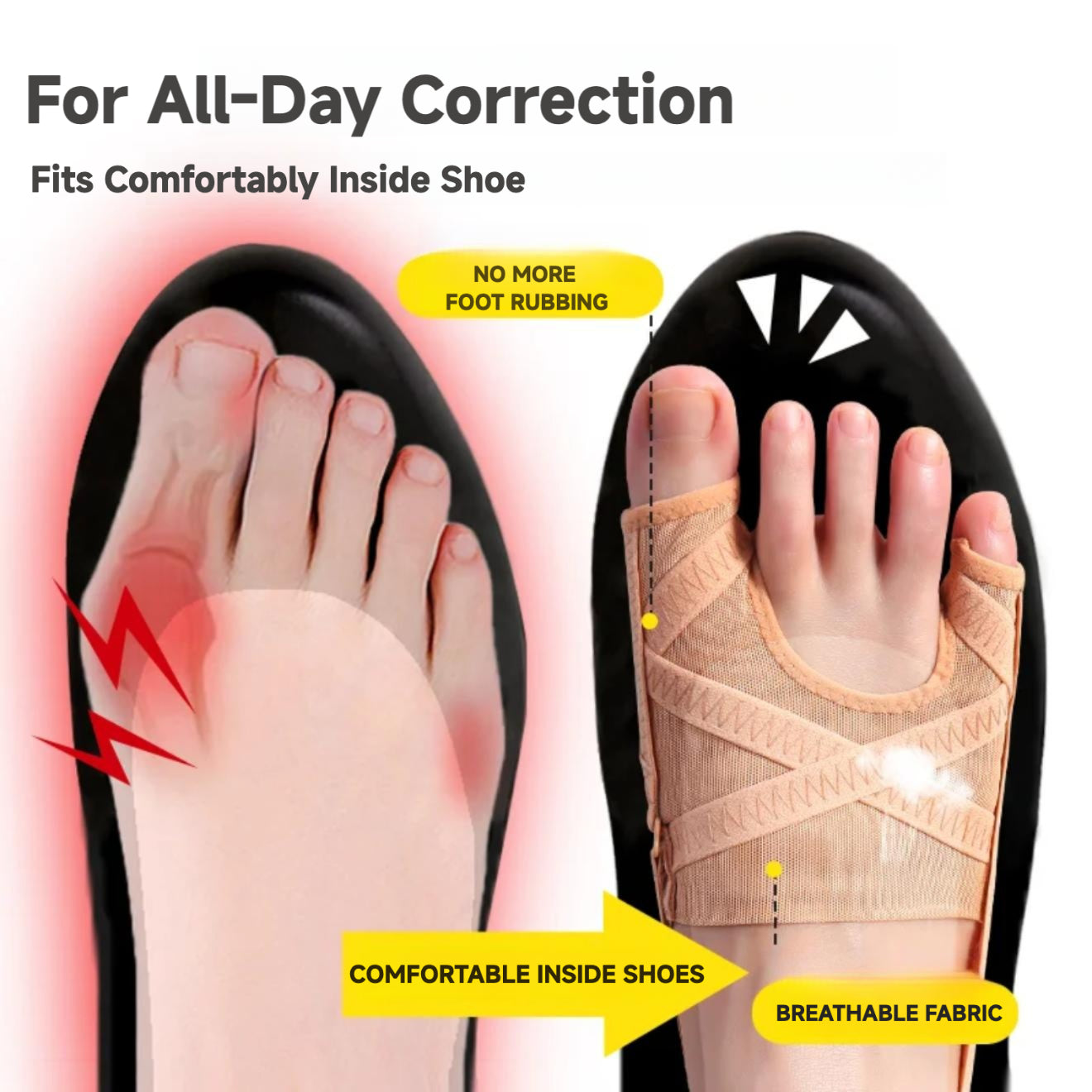 Hallux Valgus Correction
