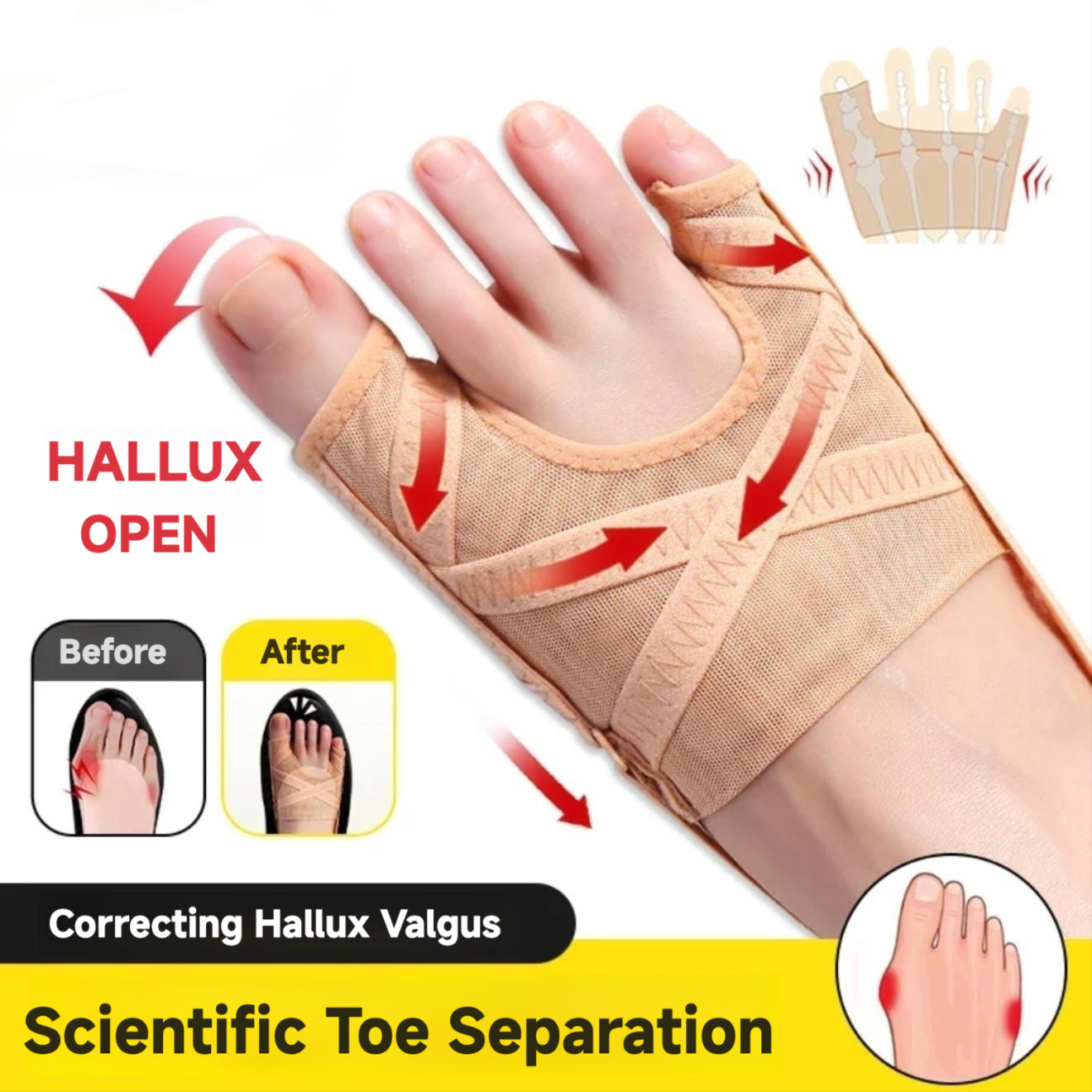 Hallux Valgus Correction